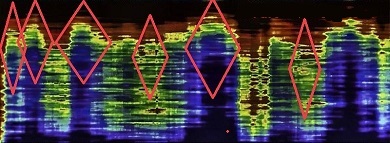 Sar Scan
