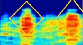 Sar Scan